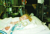 Lauren after Nakaidoh Procedure 7/97